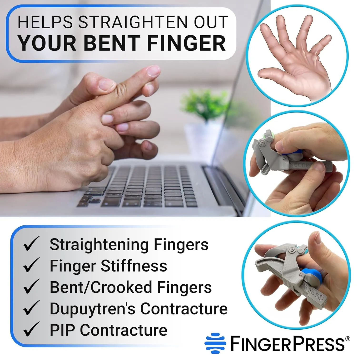 Finger Straightener | PIP Extension Orthosis/Splint For Bent Fingers, PIP Flexion Contractures | Adjustable Joint Stretcher Device | Made in USA | Gray/Medium